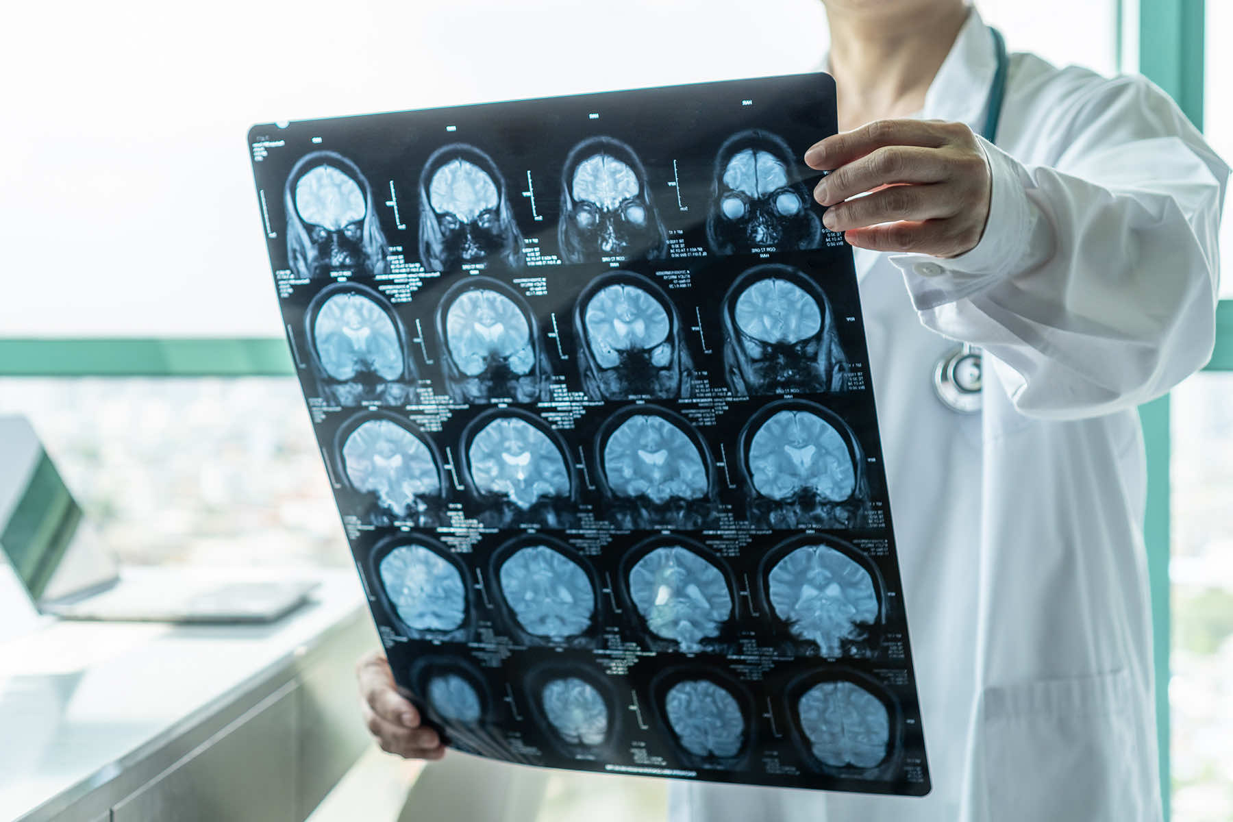 Glioblastoma Immunotherapy Solution