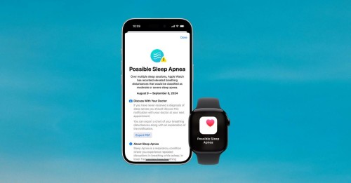 Sleep Apnea Detection on Apple Watch Series 10: Latest Health Innovation