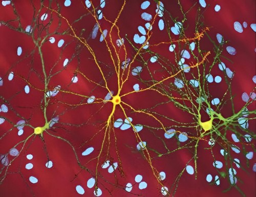 Huntingtin Protein Innovation: DNA Repair Breakthrough