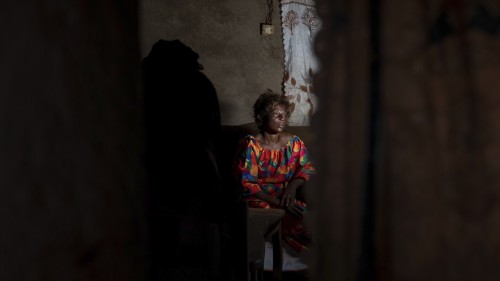 Mpox Solution for Sex Workers in Kamituga, DRC