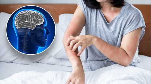 Shingles Vaccine: Tips for Healthy Cognitive Wellness
